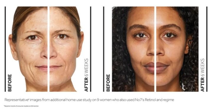 benefits of retinol - image showing the before and after
